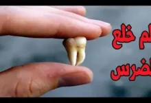 تفسير رؤية خلع الضرس في المنام