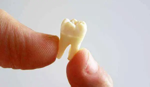 تفسير رؤية خلع الضرس في المنام