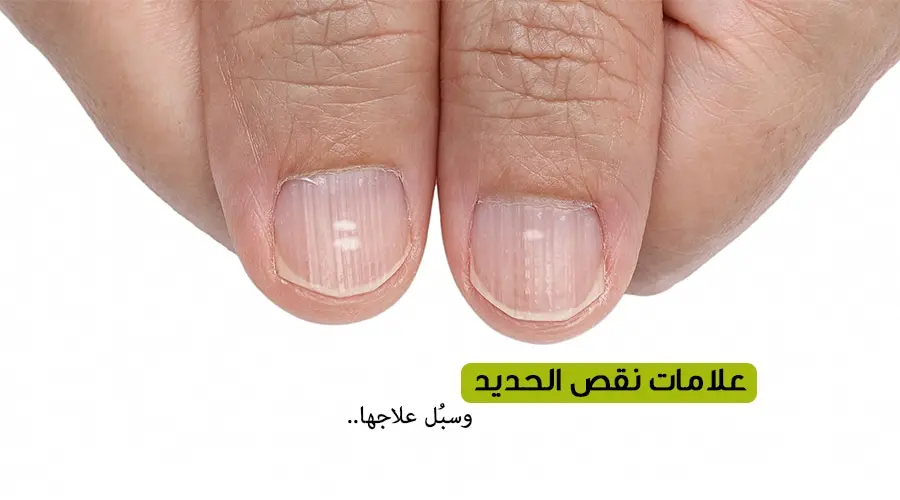 أعراض نقص الحديد عند النساء